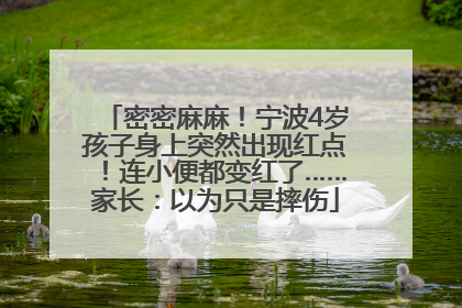 密密麻麻！宁波4岁孩子身上突然出现红点！连小便都变红了……家长：以为只是摔伤